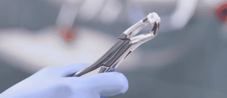 delaying tooth extraction risks