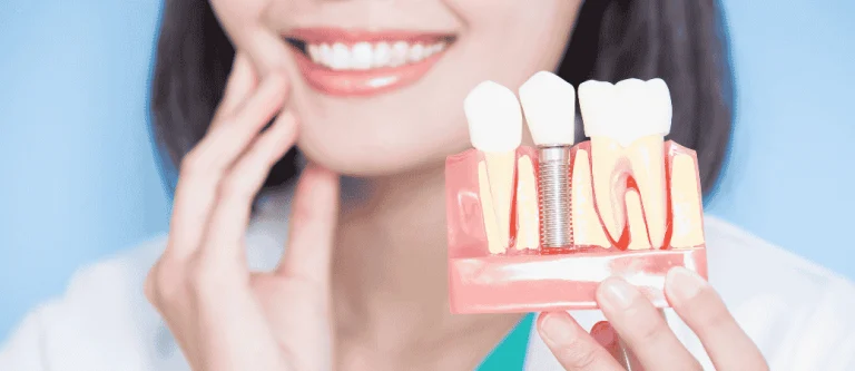 single vs multiple dental implants